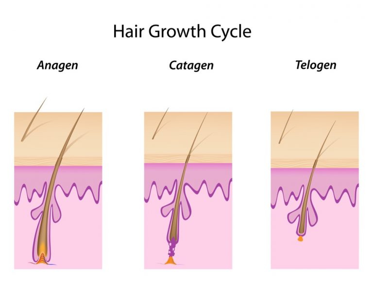 What is Telogen Effluvium - Trichology