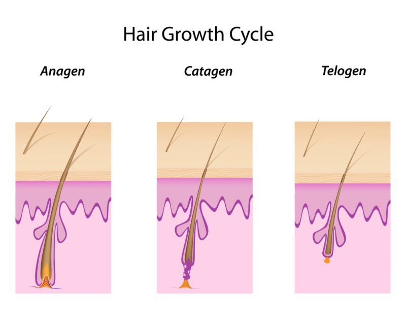 Telogen Effluvium