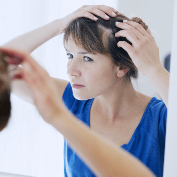5 Minoxidil For Female Pattern Hair Loss