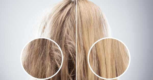 The Difference Between Hair Loss And Hair Breakage - Trichology