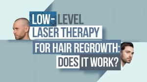 Low-Level Laser Therapy For Hair Regrowth: Does It Work?