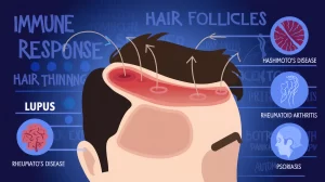 hair loss 