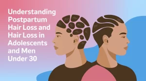 Understanding Postpartum Hair Loss And Hair Loss In Adolescents And Men Under 30